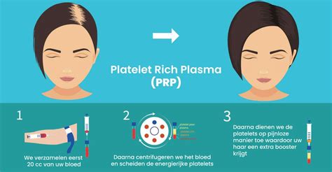 PRP Behandeling: Een Nieuwe Aanpak Voor Haarverlies